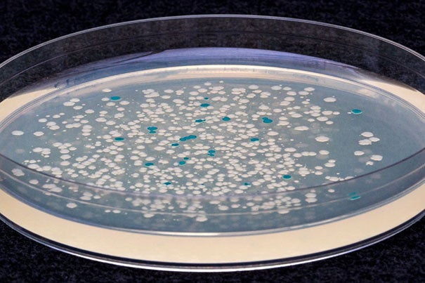 The blue reflects colonies of engineered E. coli bacteria that were actively dividing at the time the chemical ATC was added, while those that were not dividing at that time remain white.