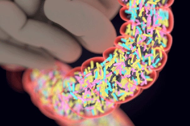 A Medical School study found that a guardian gene, which protects against Type 1 diabetes and other autoimmune diseases, exerts its pancreas-shielding effects by altering the gut microbiota.