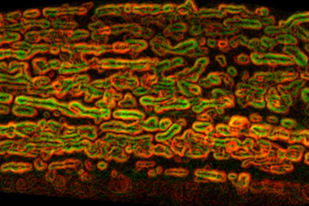 “Although previous work has shown how intermittent fasting can slow aging, we are only beginning to understand the underlying biology,” said William Mair, associate professor at Harvard Chan School. Mitochondrial networks in the muscle cells of C. elegans (pictured) have been key elements in the study.