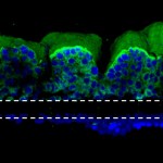 “When cancer patients receive radiation treatment for a specific organ, other organs are also affected, mostly the bone marrow, the lung, and the gut,” says first author Sasan Jalili-Firoozinezhad. Shown are normal, undamaged villi-like protrusions in the small intestine.