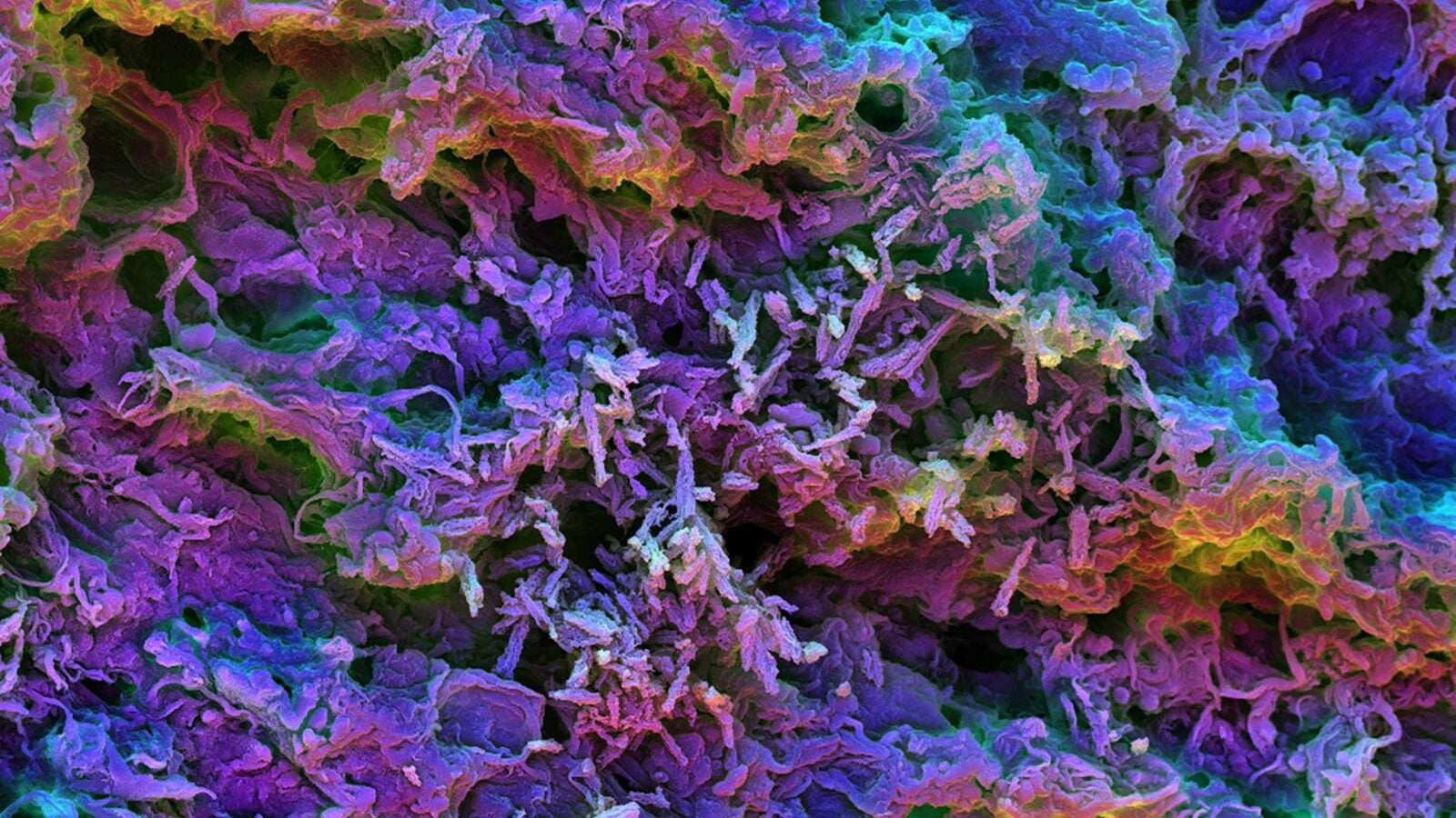 This scanning electron micrograph image shows the MSR-PEI scaffold presenting tumor-expressed peptides. After it’s injected under the skin of mice, the biomaterial fills with dendritic cells that can be seen here as small, round shapes interacting with the spiky scaffold structure.