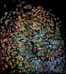 Cells of a zebrafish eye, computationally "exploded."
