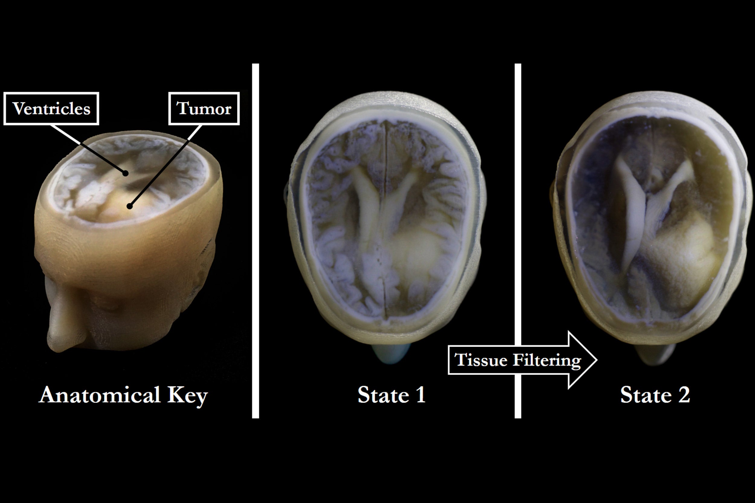 forms of things unknown ferrara brain pan