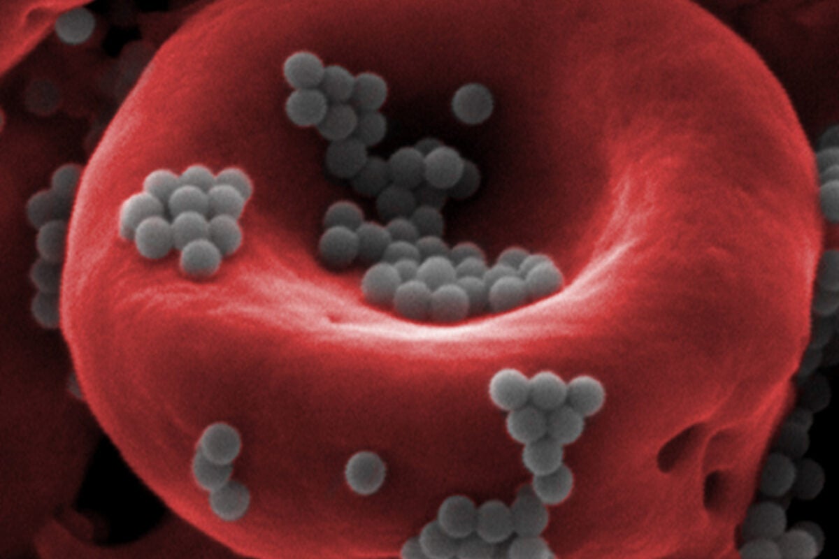 Nanoparticles (gray) can “hitchhike” a ride on red blood cells (red) to avoid detection by the liver and deliver higher doses of drugs for a longer period of time than free-floating nanoparticles administered via the blood.
