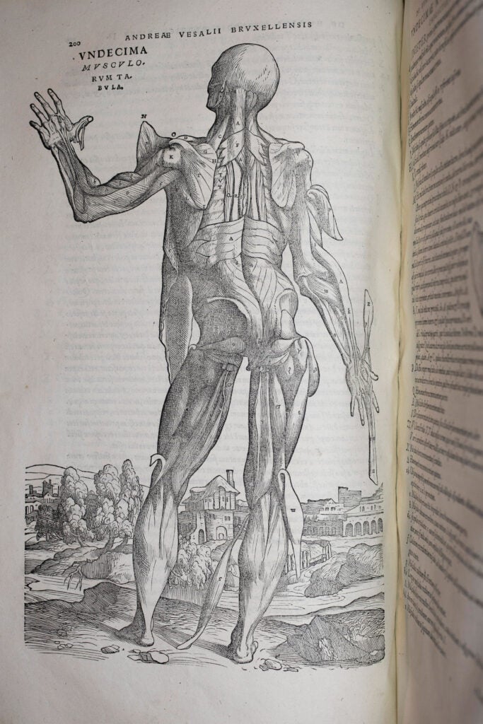 Andreae Vesalii Brvxellensis scholae medicorum Patauinae professoris, De humani corporis fabrica libri septem.