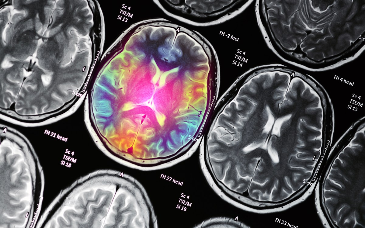 Conceptual illustration of MRI scans.