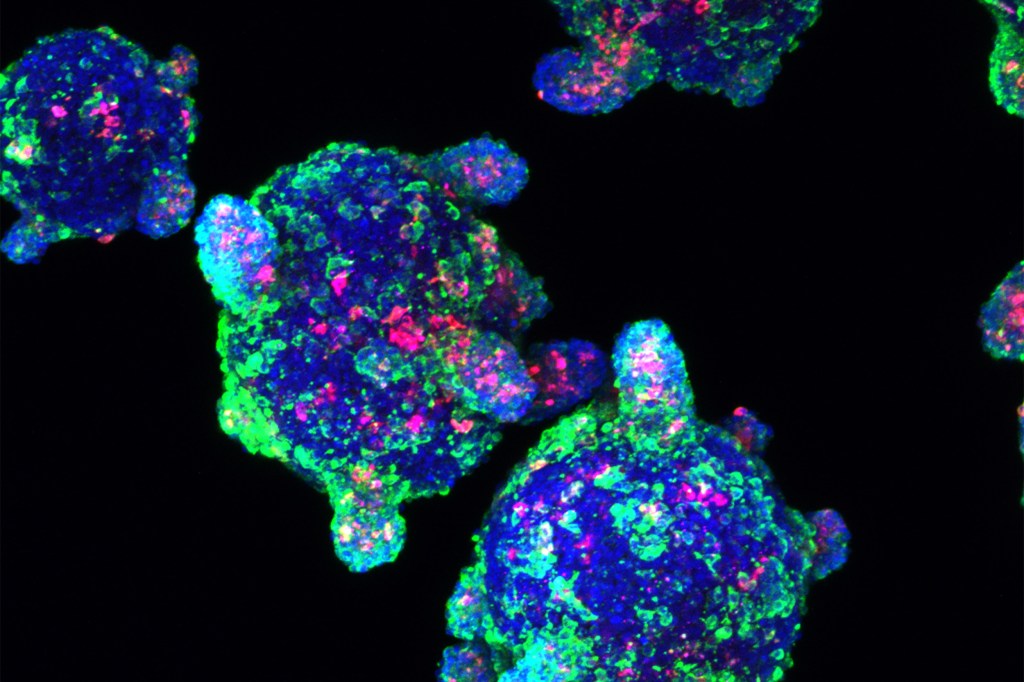 Beta cells made from stem cells, as seen under the microscope.