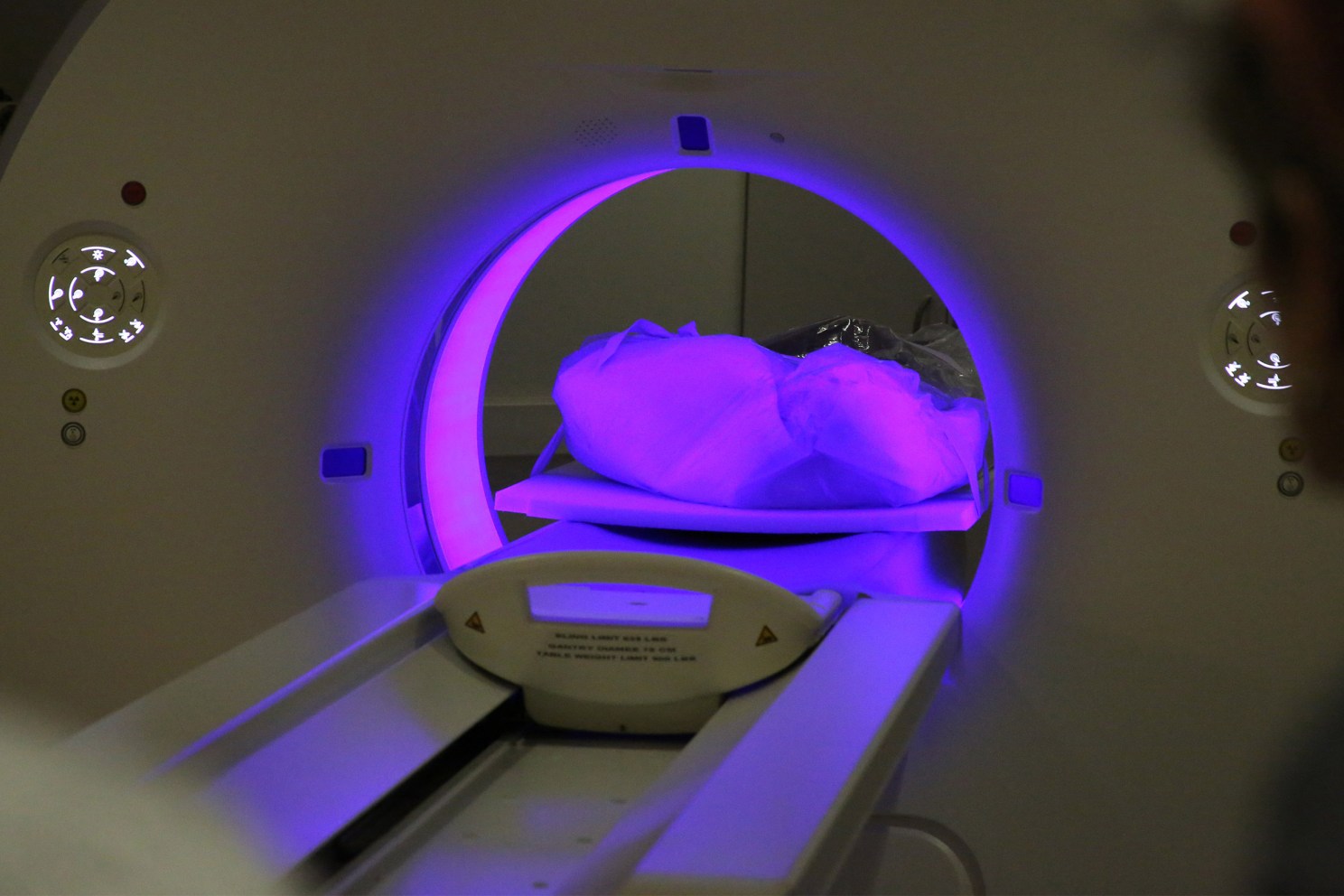 CT scan of mummy