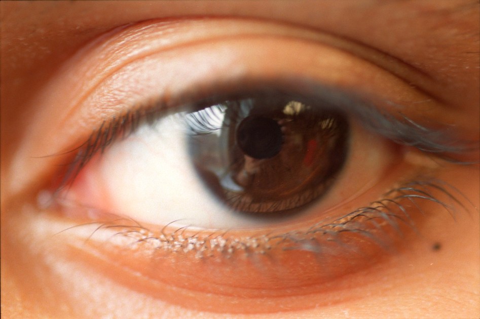Harvard researchers explore macular degeneration through a new lens ...