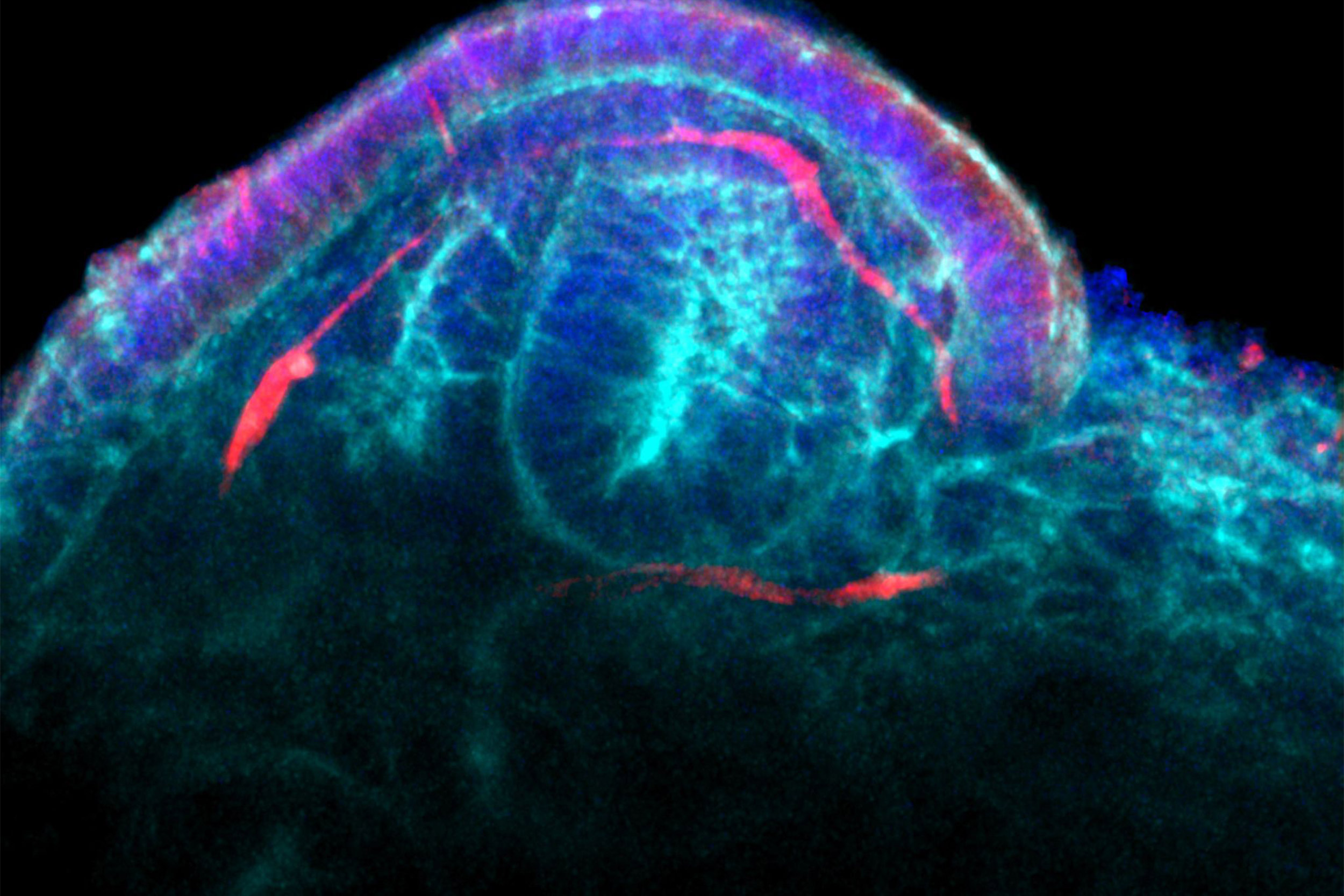 A developing glomerulus in a kidney organoid