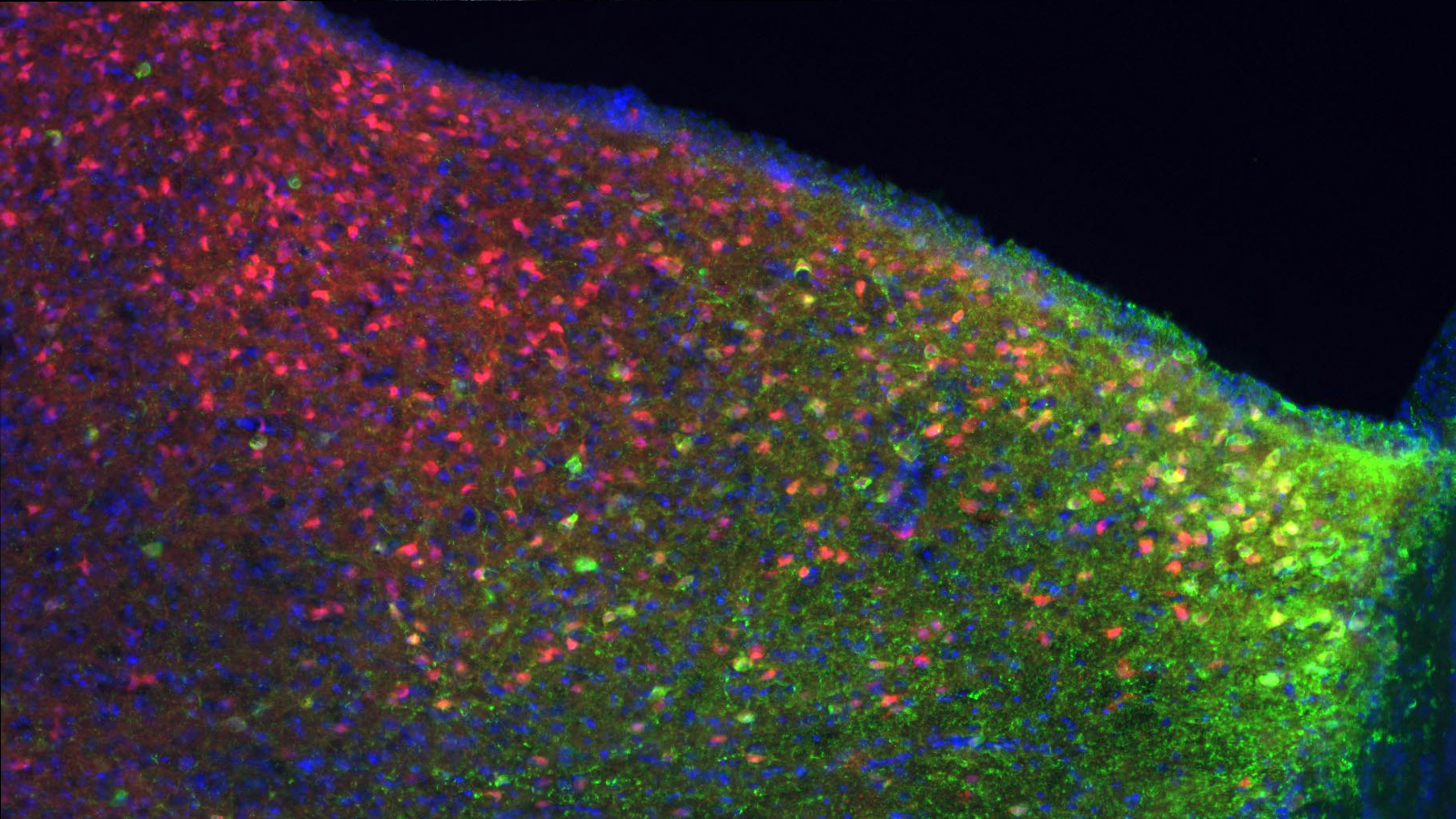 Threat sensors: the neurons that regulate fear response — Harvard Gazette