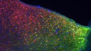 Somatostatin neurons