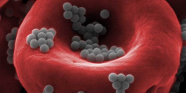 Nanoparticles