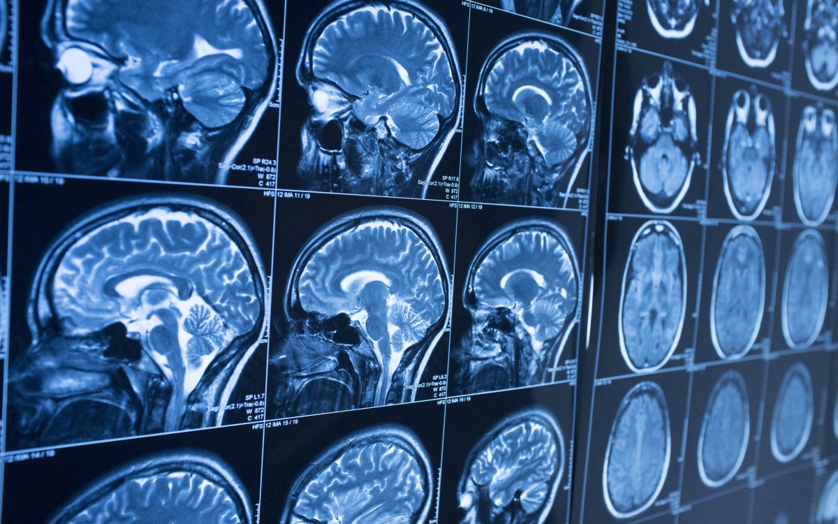 Measuring brain function image of scans