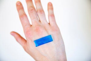 Hand with tough gel adhesive bandage