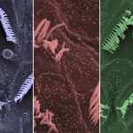 Sensory hair bundles in the inner ear of a normal mouse (left), a mouse with the Beethoven mutation (middle), and a Beethoven mouse after gene therapy treatment (right). Bundles are nearly normal in the treated mouse. 