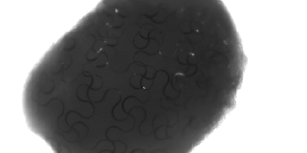 Contraction of cyborg human cardiac organoid