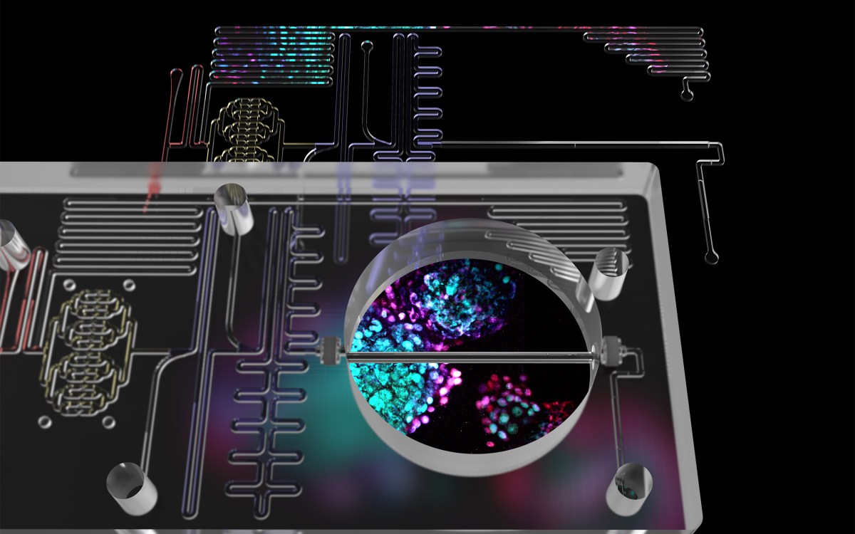 Islet on a chip