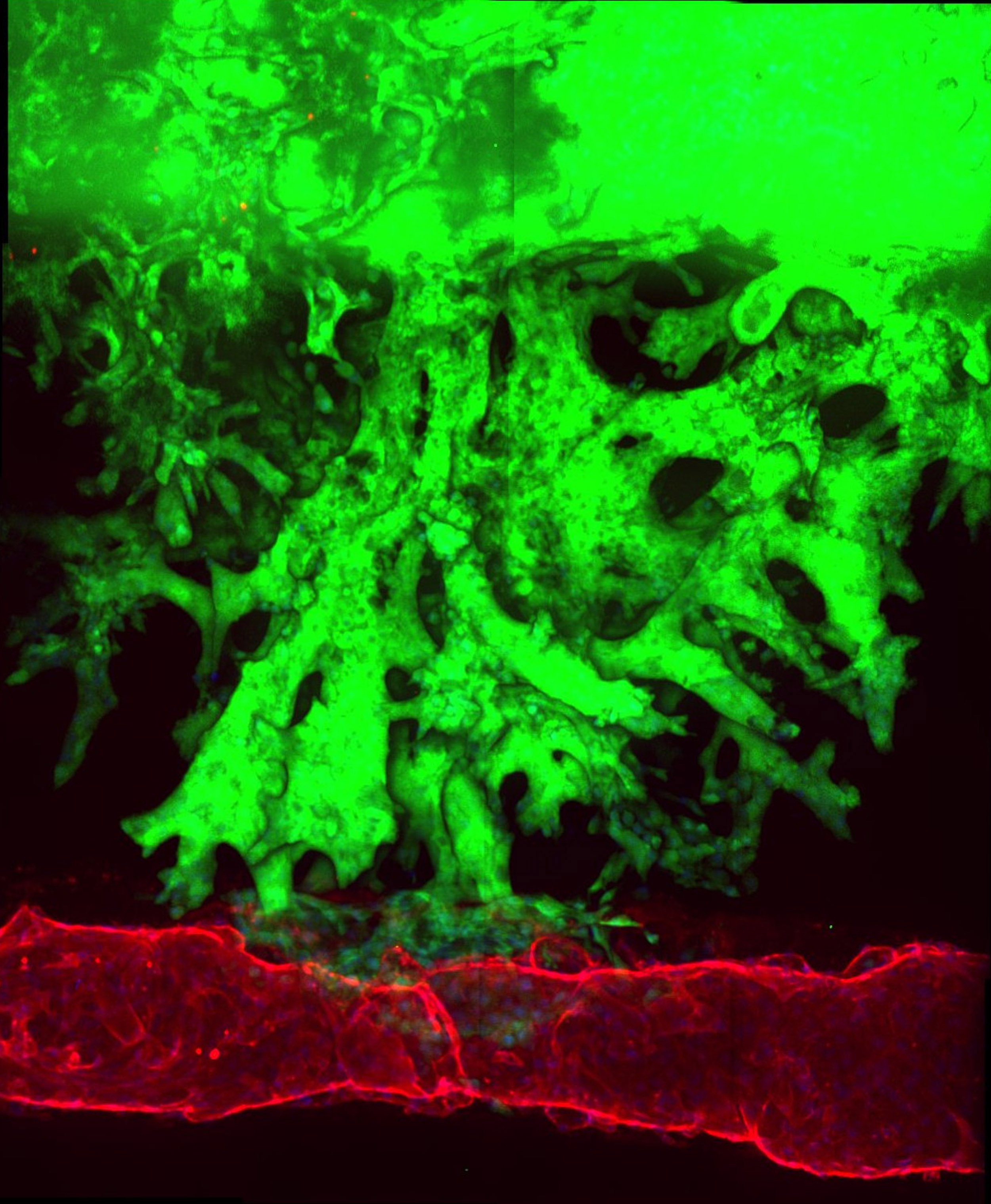 Pancreatic cancer cells