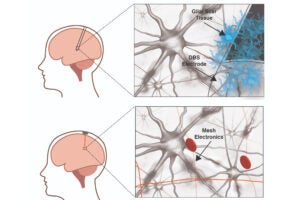 raditional-neural-electrodes-versus-mesh-electronics