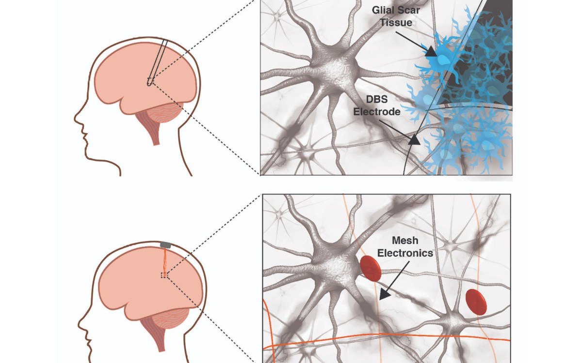 raditional-neural-electrodes-versus-mesh-electronics