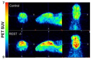Mice lacking the protein REST (bottom) showed much higher neural activity in the brain than normal mice.