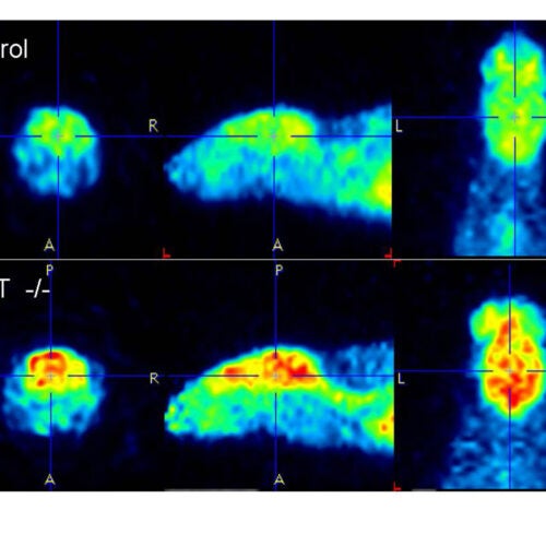 Mice lacking the protein REST (bottom) showed much higher neural activity in the brain than normal mice.