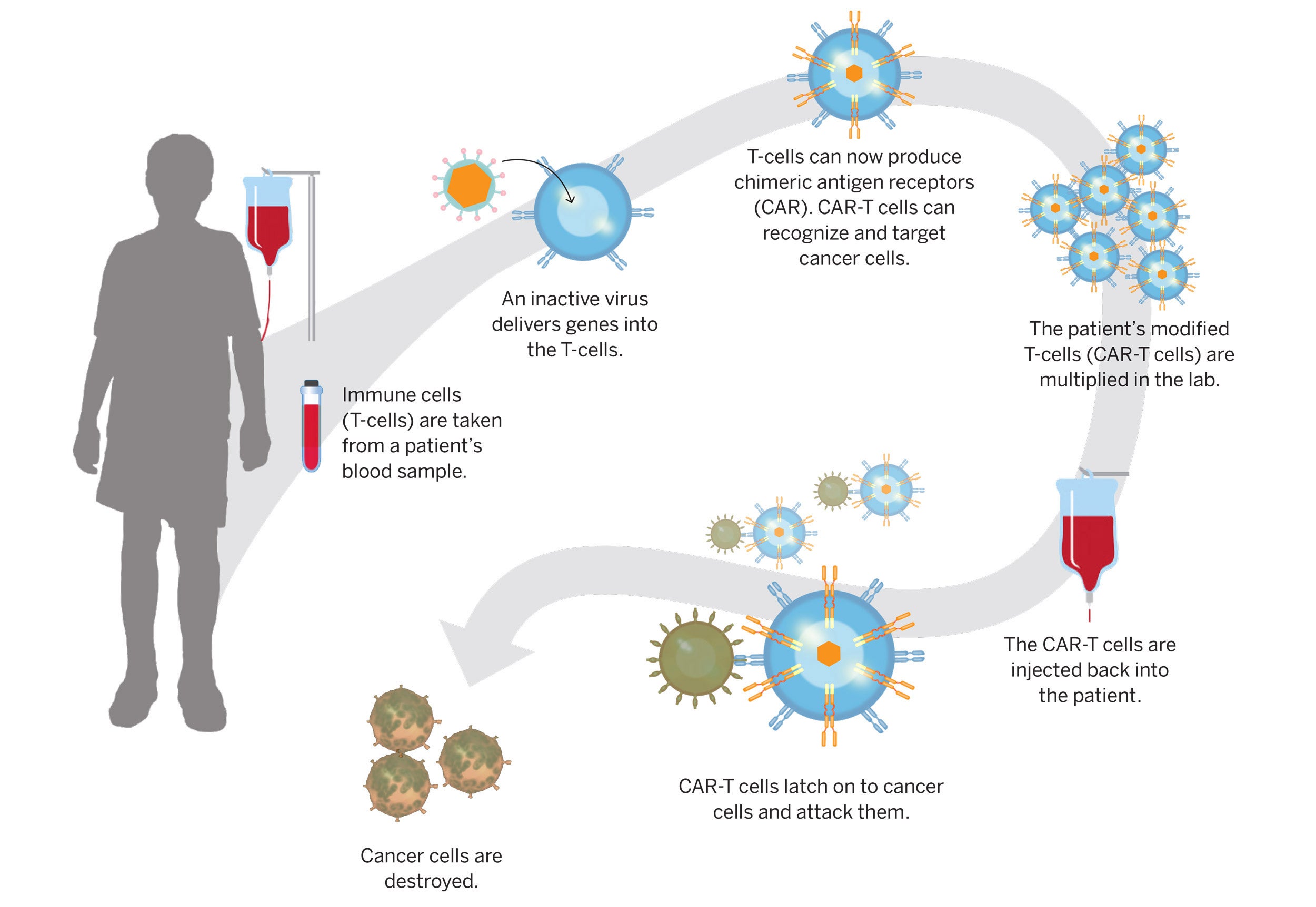 graphic of CAR-T Cell therapy.
