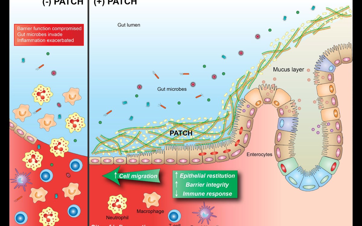 Graphic showing how bioactive material works in the intestines.