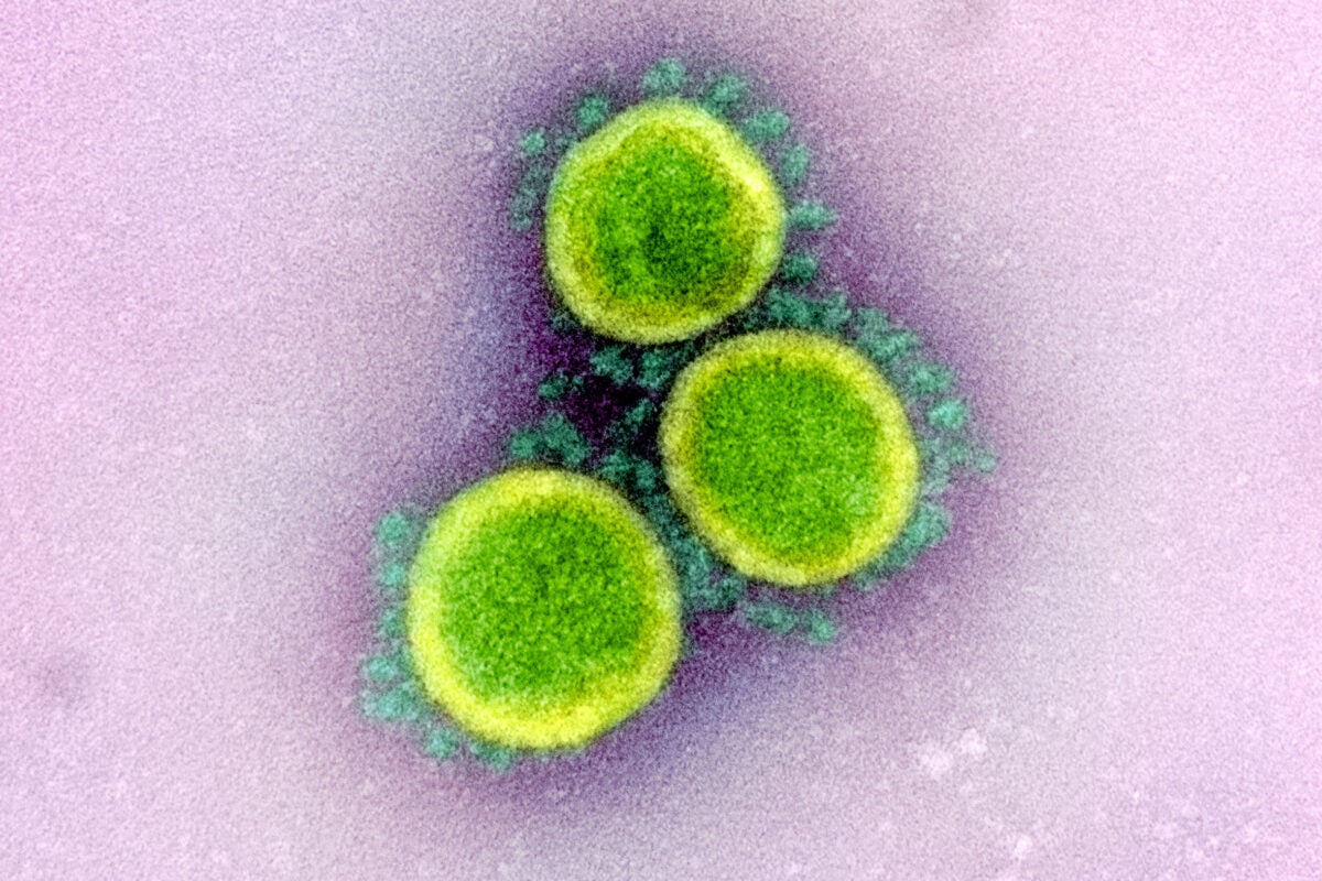 Illustration of Novel Coronavirus SARS-CoV-2