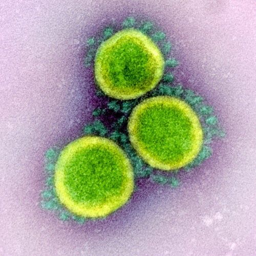 Illustration of Novel Coronavirus SARS-CoV-2