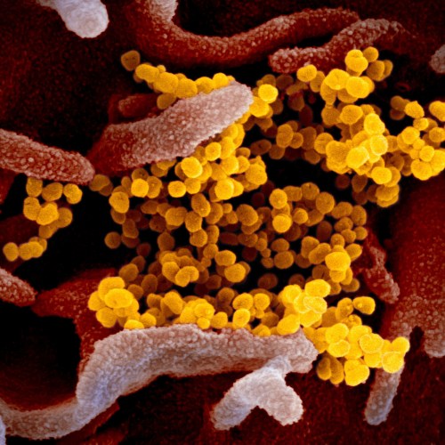 SARS-CoV-2, the virus that causes COVID-19.