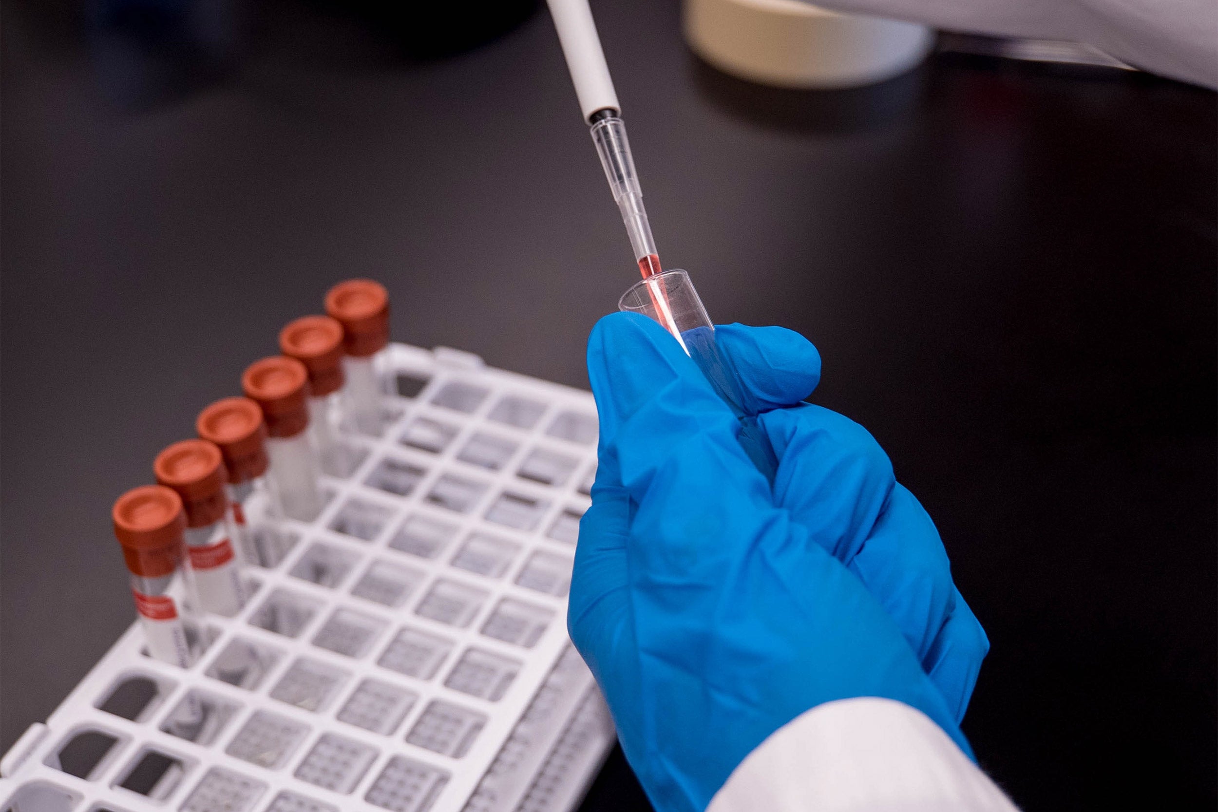 Harvard scientists work to find coronavirus treatment – Harvard ...