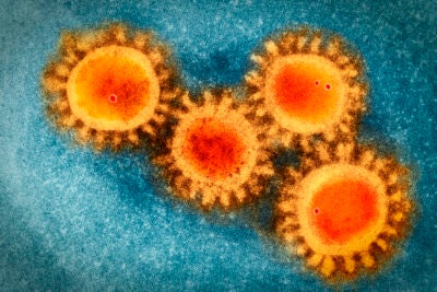 An electron microscopy photo of the coronavirus COVID-19.