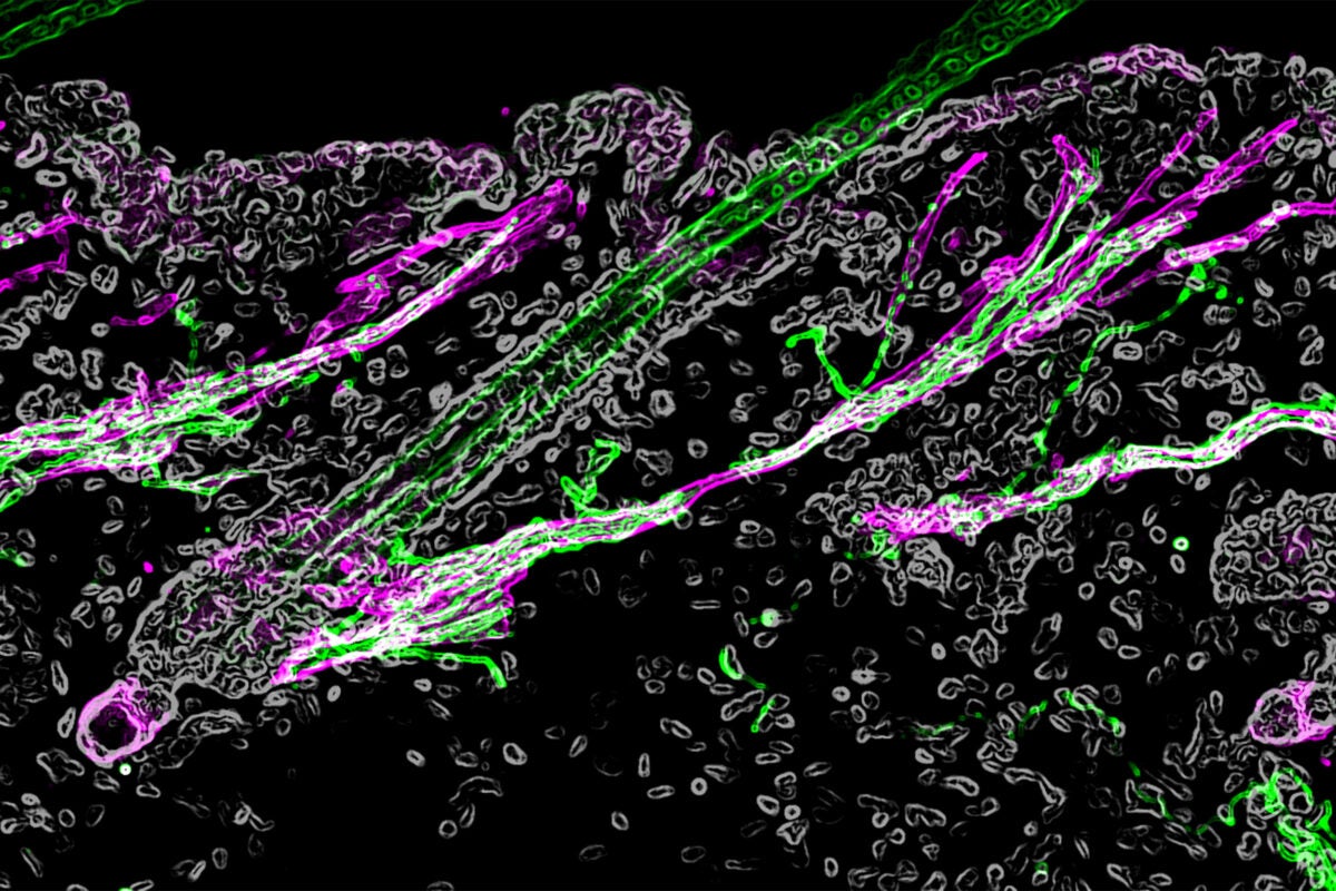 The hair follicle under the microscope, with the sympathetic nerve in green and the muscle in magenta.