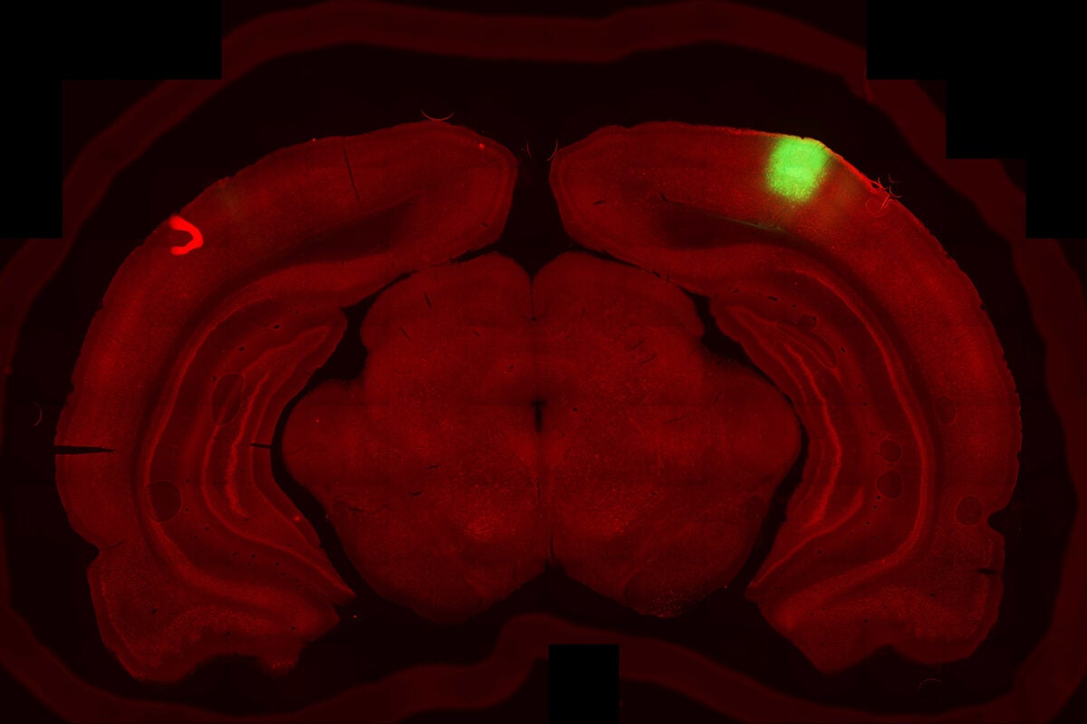 Rat brain scan.