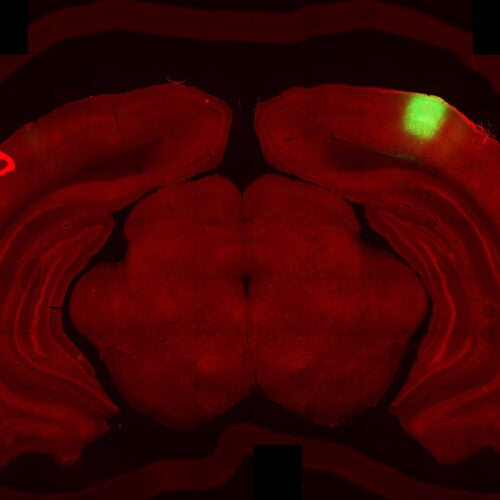쥐 뇌 스캔.