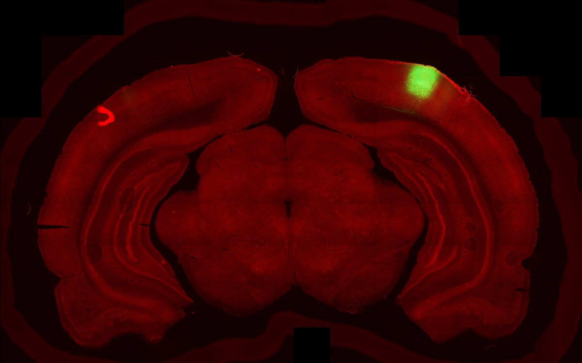 Rat brain scan.