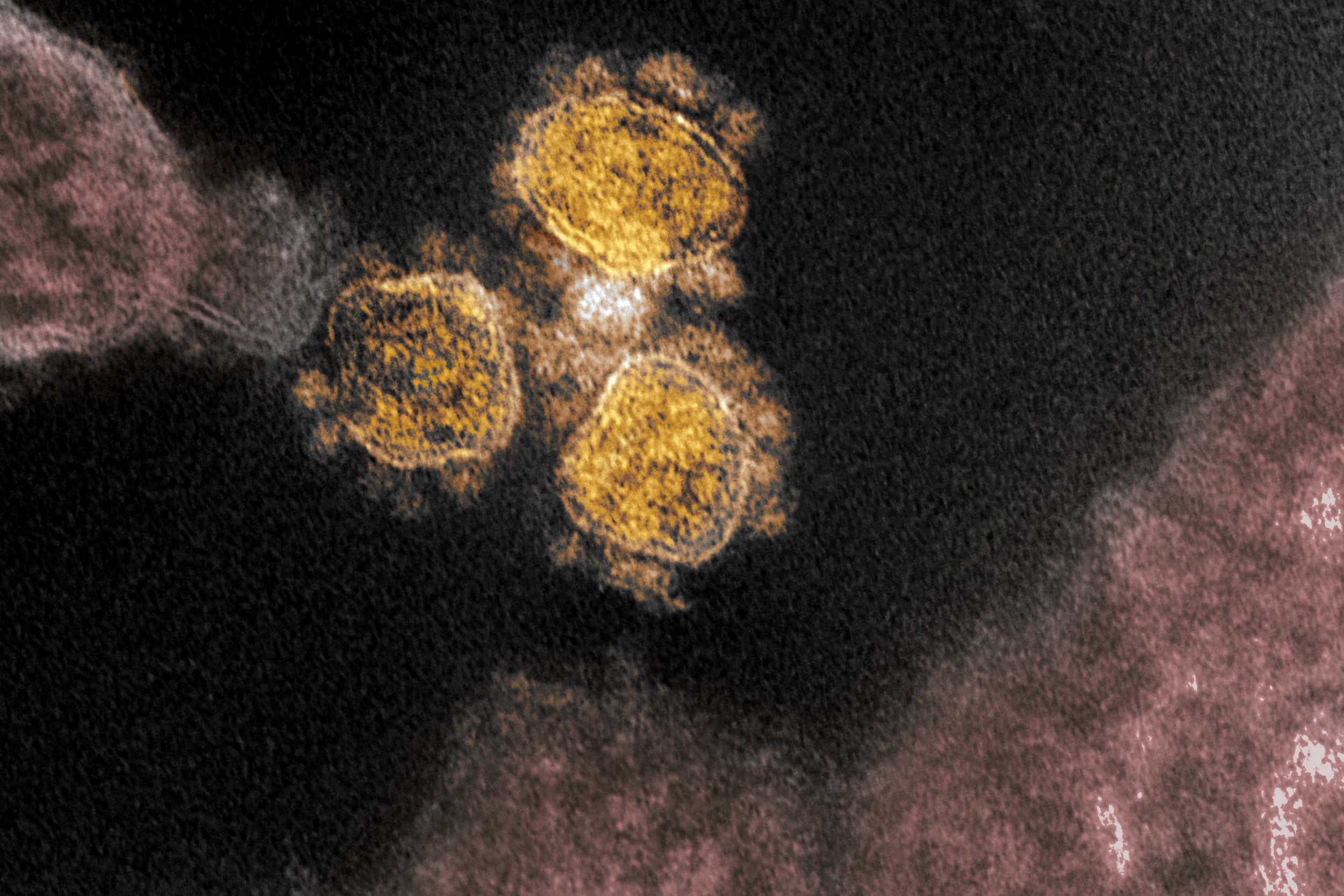 SARS-CoV-2 particles.