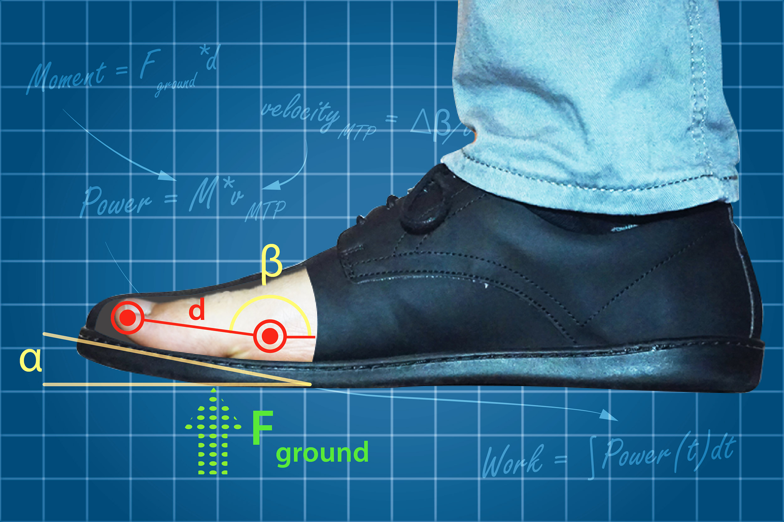 Skalk droogte moederlijk Curve on shoes makes walking easier, but may lead to foot problems –  Harvard Gazette