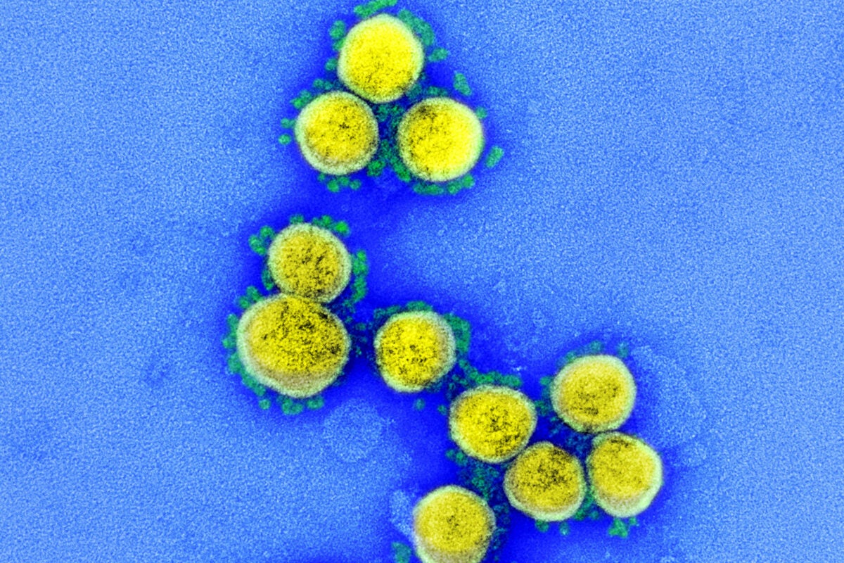 SARS-CoV-2 virus particles.