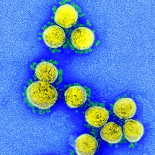 SARS-CoV-2 virus particles.