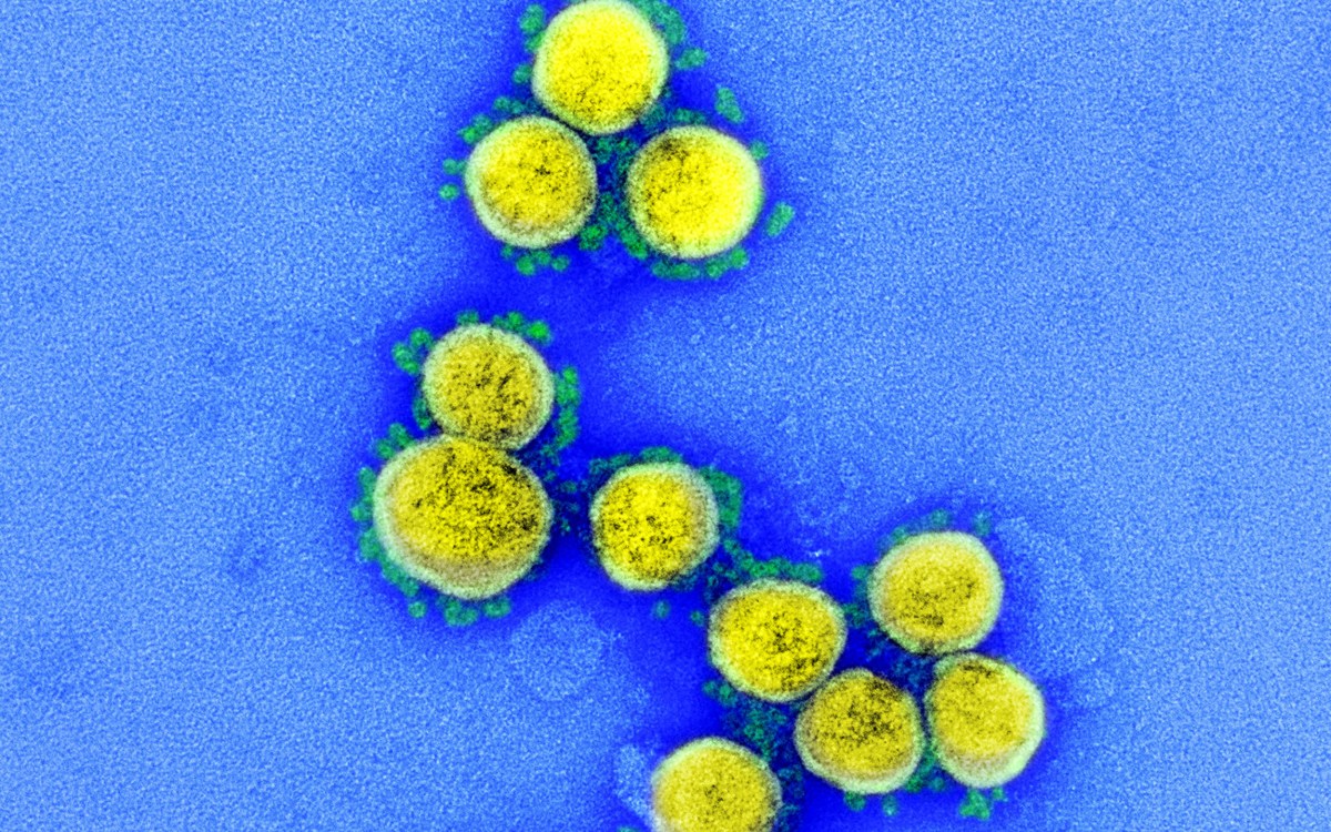 SARS-CoV-2 virus particles.