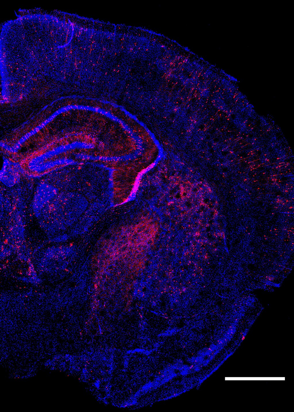 Multiple genetic changes to cells.