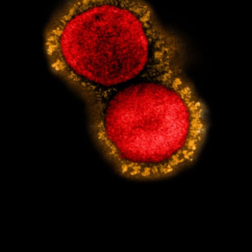 SARS-CoV-2 virus particles (U.K. variant)