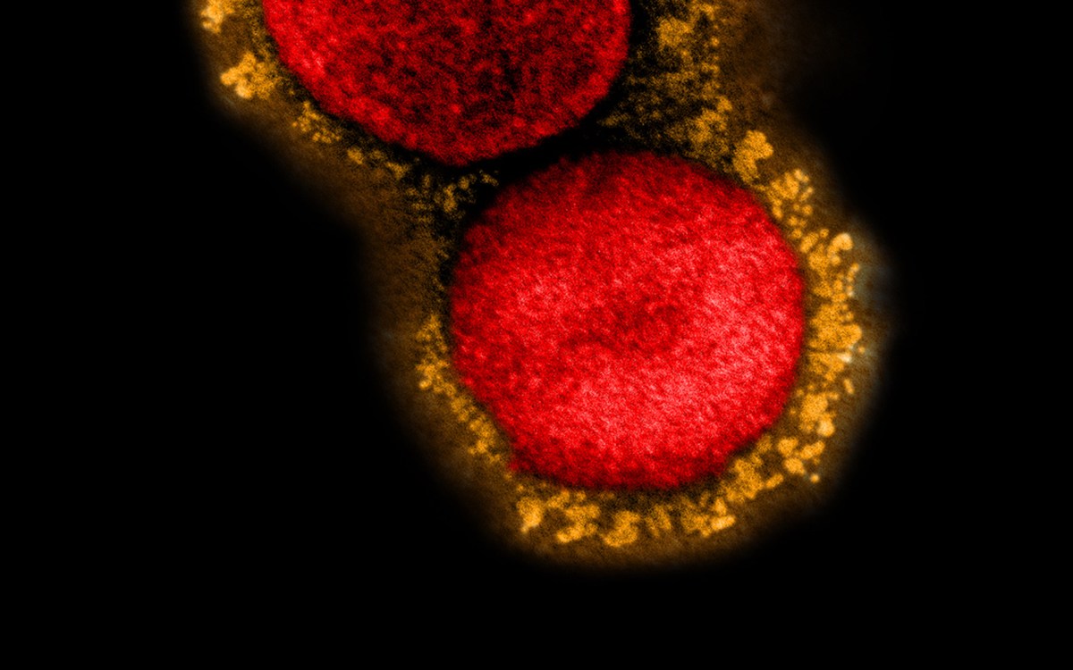 SARS-CoV-2 virus particles (U.K. variant)