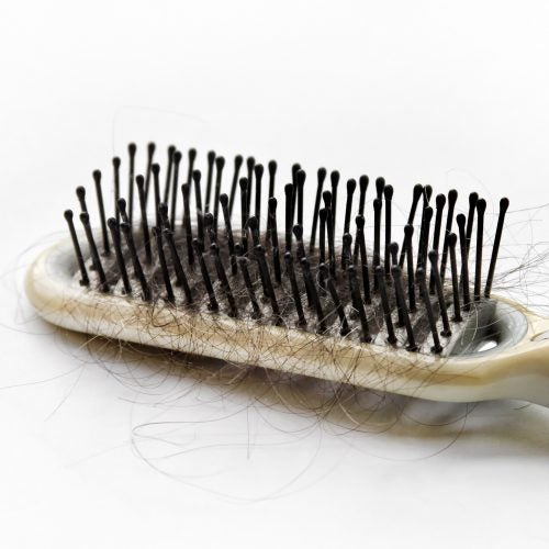 Hair loss concept of close up hairbrush and fallen hair.