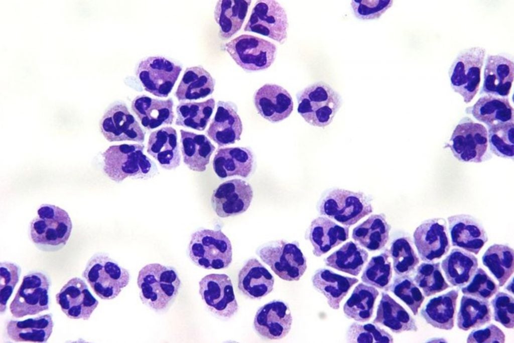 Image demonstrates a Giemsa stain of normal human neutrophils.