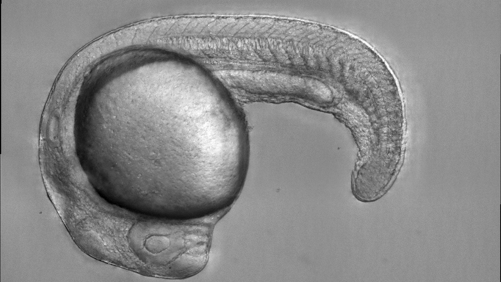 Zebrafish embryo.