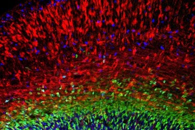 Microscopy image of the developing cerebral cortex